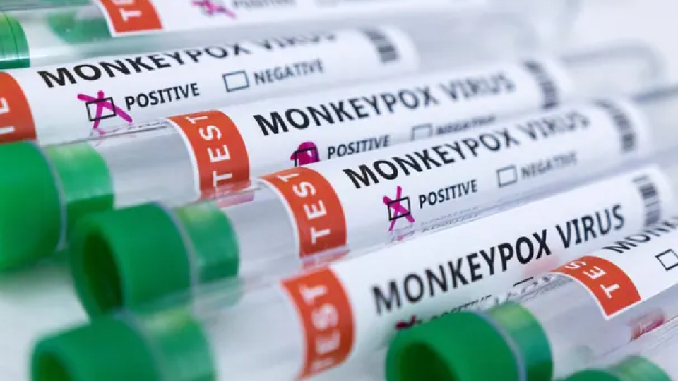 The Monkeypox Case: A Fifth Person in NYC Tested Positive